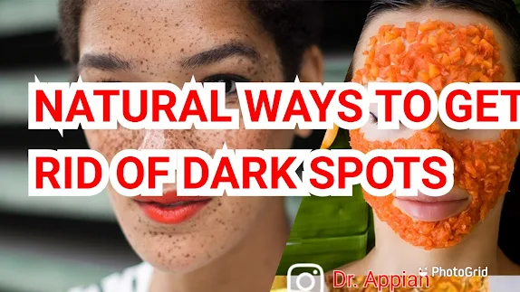 Natural Remedies To Get Rid of Dark Spots
