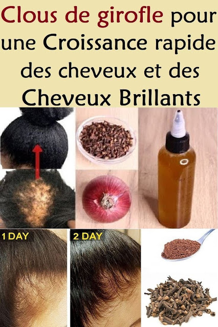 Comment utiliser les clous de girofle dans les cheveux