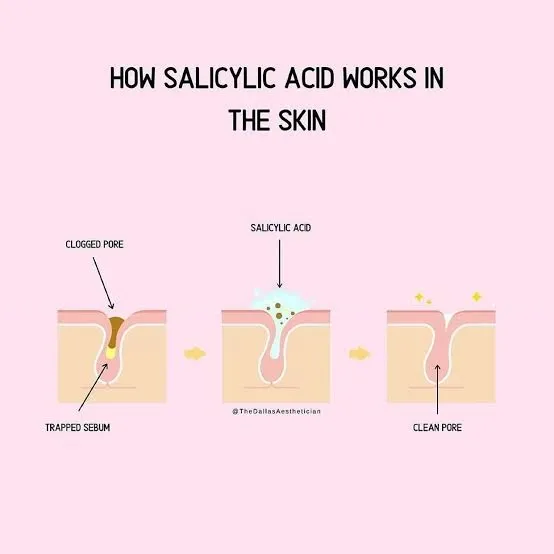 Cara pakai Salicylic Acid