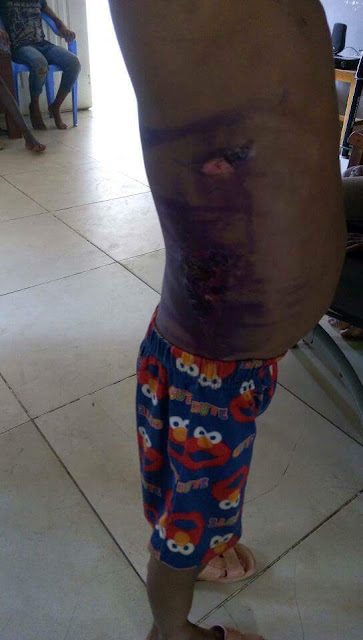 Photos: Man arrested in Abuja for burning 7-year-old son with hot pressing iron over food