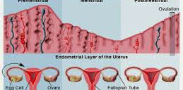  MENORRHAGIA, MENSTRUASI YANG BERLEBIHAN, BAGAIMANA CARA MENGETAHUINYA?