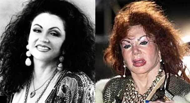 Jackie Stallone Before And After