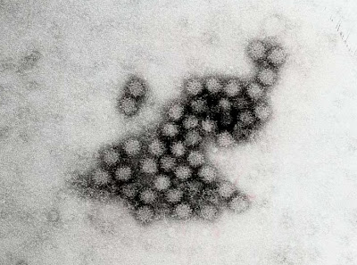 NOROVIRUS