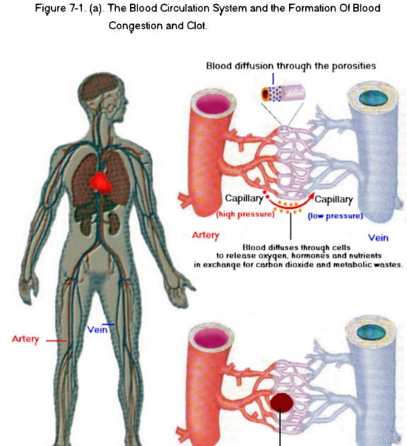 Acupuncture & Alternative Treatment: Piles Cured