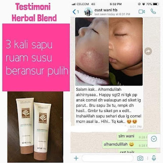 Krim Ruam Susu Peluh Lampin Gatal Bayi Di Muka Leher Pipi