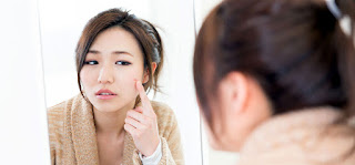 Is Oregano Oil An Effective Cure For Acne?