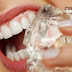 Dişlerinize Zarar Veren 10+ Etmen