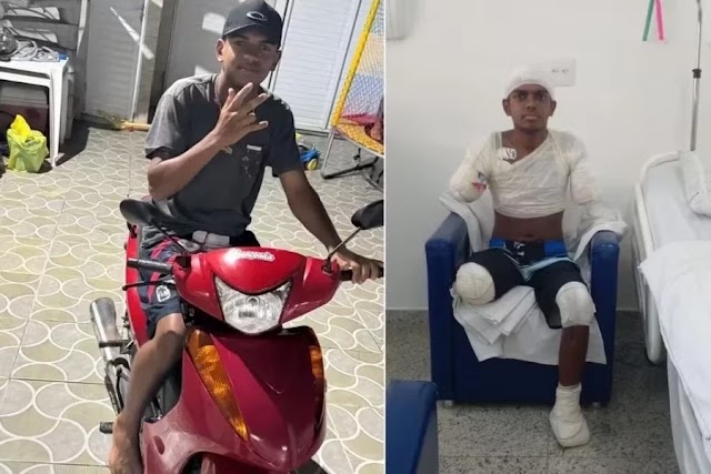 Adolescente tem braços, perna e parte de pé amputados após levar choque de alta voltagem no litoral de SP