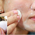 A Very Simple Trick To Get Rid Of Blackheads Forever, Using 1 Ingredient!