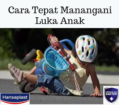 Cara tepat menangani luka anak