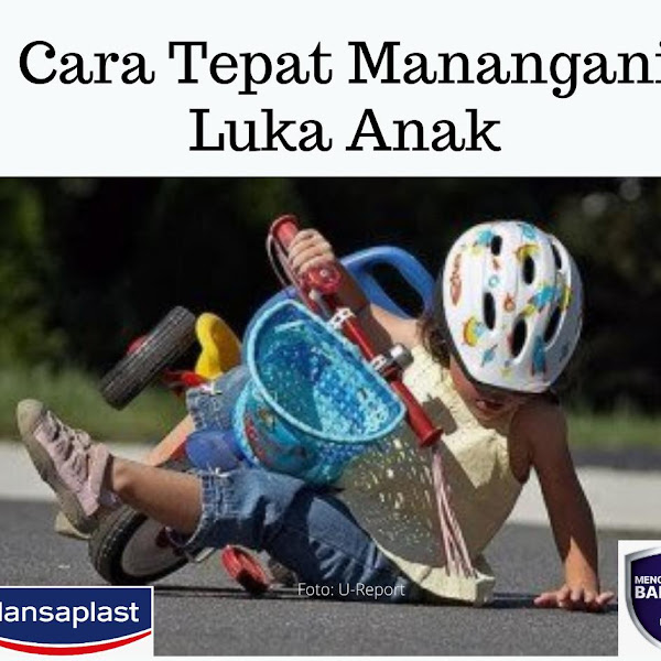  Cara Tepat Menangani Luka Anak Agar Tidak Terjadi Infeksi dengan Hansaplast