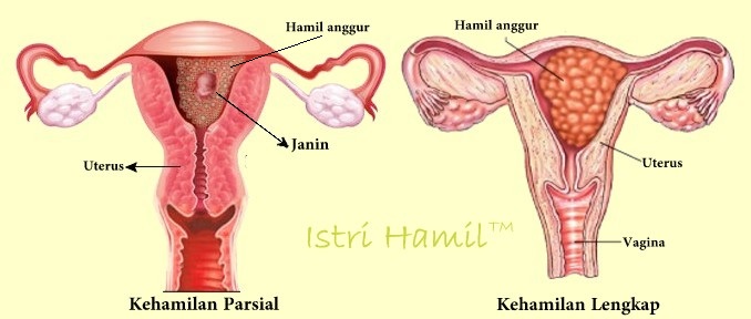 gambar hamil anggur