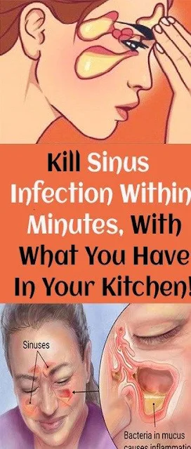 Kill Sinus Infection Within Minutes, With What You Have In Your Kitchen!