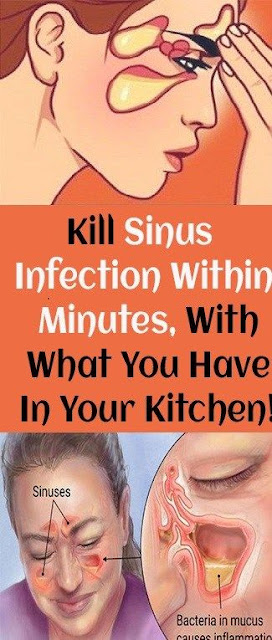 Kill Sinus Infection Within Minutes, With What You Have In Your Kitchen!