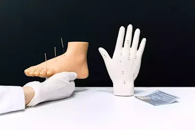 Acupuncture treatment benefits and risks
