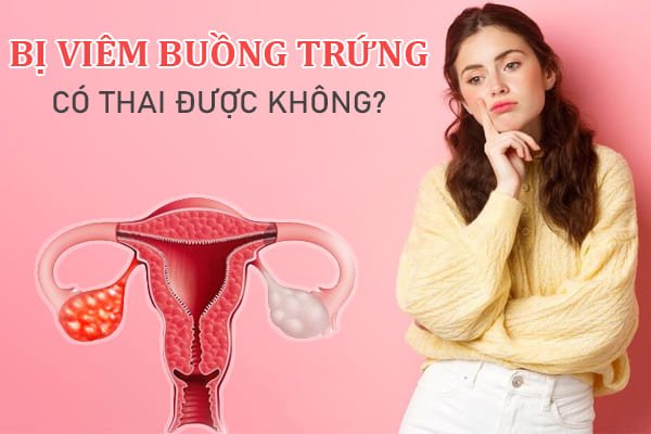 Viêm buồng trứng có thai được không