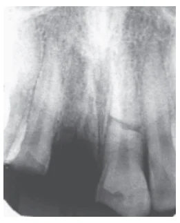 Figura 2: Imagem radiográfica