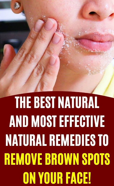 The Best Natural And Most Effective Natural Remedies To Remove Brown Spots On Your Face
