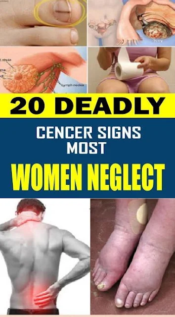 20 Deadly Cancer Signs Most Women Neglect