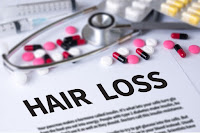 hair loss treatment medicines