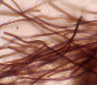 Micro hifas Cyathus stercoreus