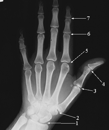 This is the type of X-ray