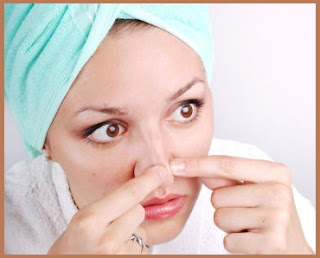 Tips to remove Blackheads