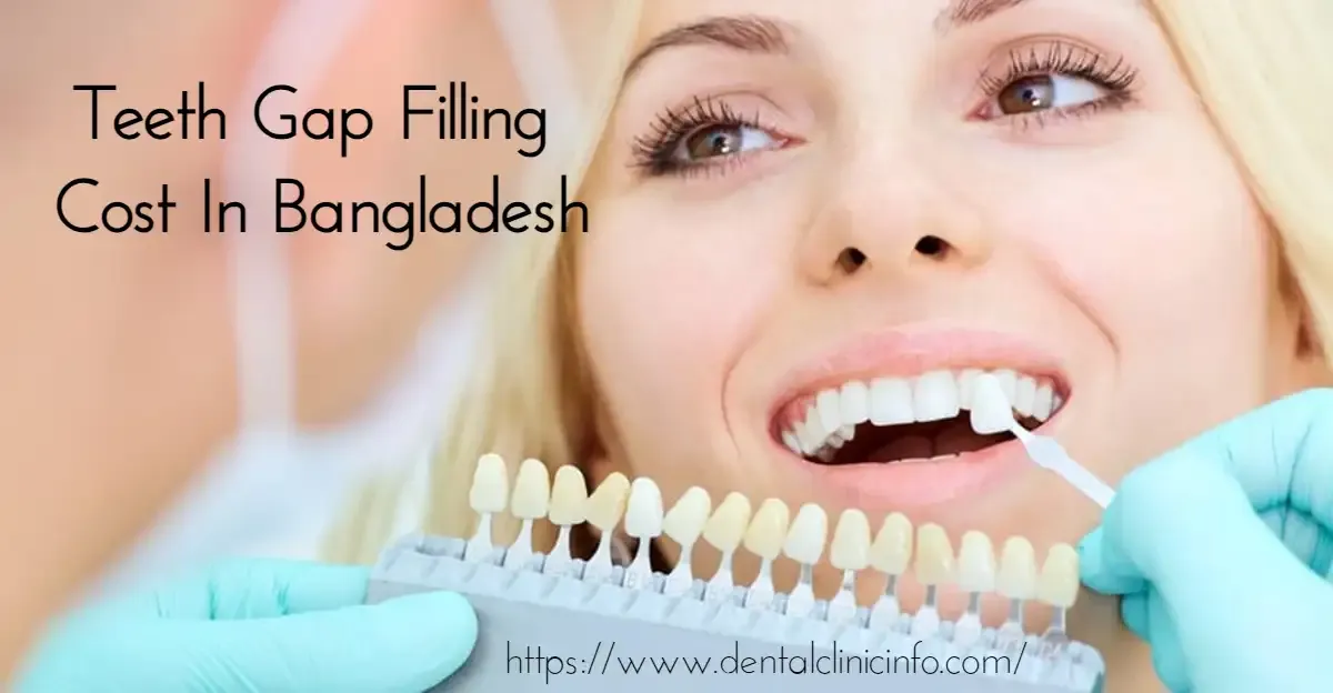 Teeth-Gap-Filling-Cost-In-Bangladesh