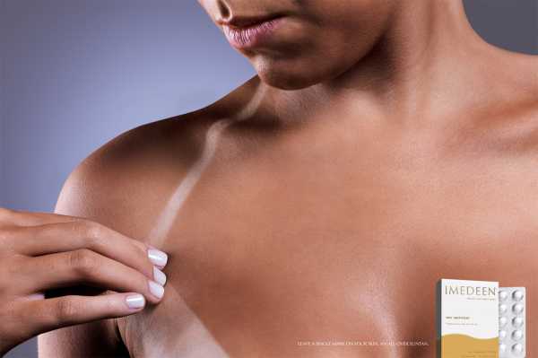 Smart sunburn