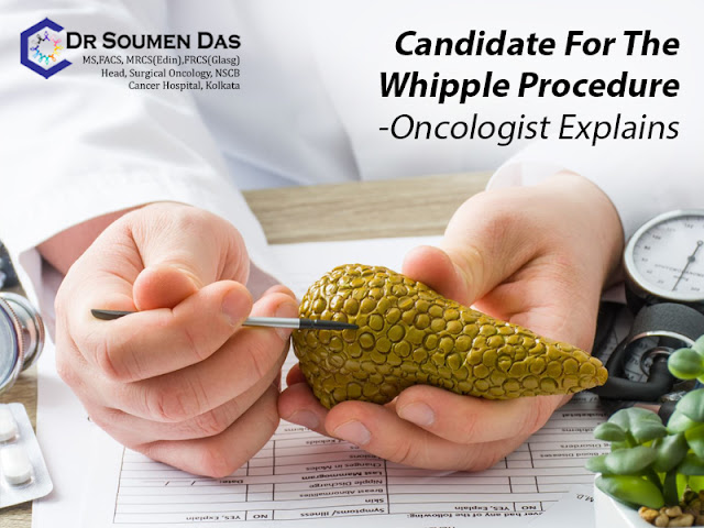 Oncologist Whipple Procedure