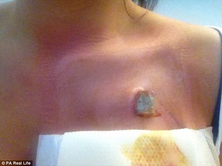 Woman Wakes to Discover a Gaping Hole Dug in her Chest...See the Shocking Reason (Photos)