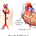 Cardiac catheterization