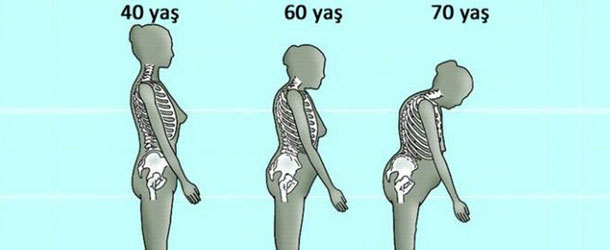   Kemik Erimesi Nedir ?