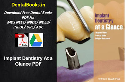 Implant Dentistry At a Glance PDF