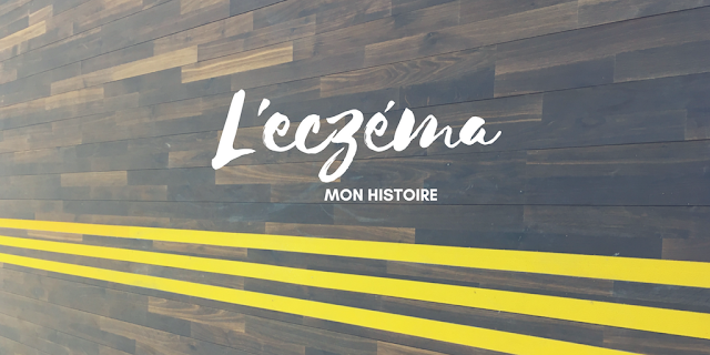  http://olalma.blogspot.fr/2017/06/mon-histoire-avec-leczema.html