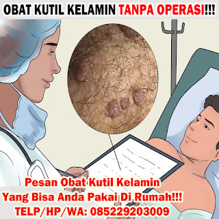 Obat Kutil Kelamin