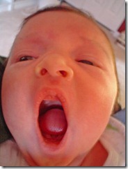 yawn