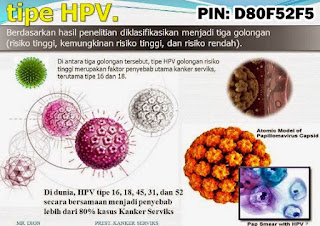 Obat Kutil Kelamin, Cara Mengobati Kutil Dikemaluan Kelamin Dari Rumah Sendiri, Dokter Obat Kutil Kelamin Terbukti Terbaik Dan Terpercaya