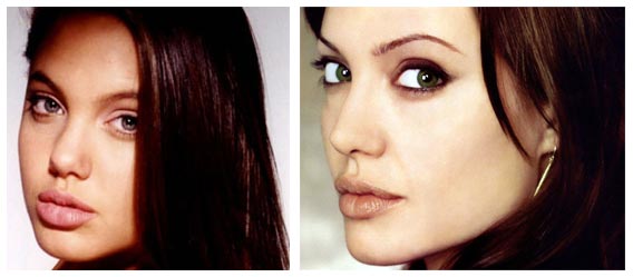 Angelina Jolie Plastic Surgery. You'll notice that her nose got thinner and 