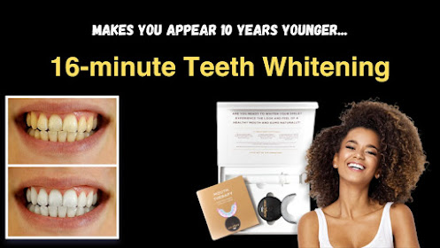 16-minute Teeth Whitening