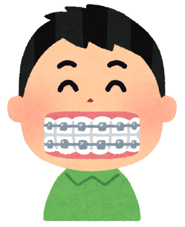 歯の矯正のイラスト かわいいフリー素材集 いらすとや 歯の矯正のイラスト かわいいフリー素材集 いらすとや