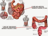 Obat Untuk Penyakit Kanker Usus Besar