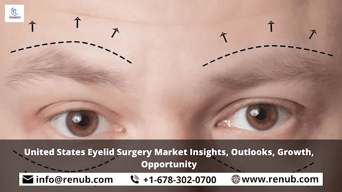 United States Eyelid Surgery Market Insights, Outlooks, Growth, Opportunity