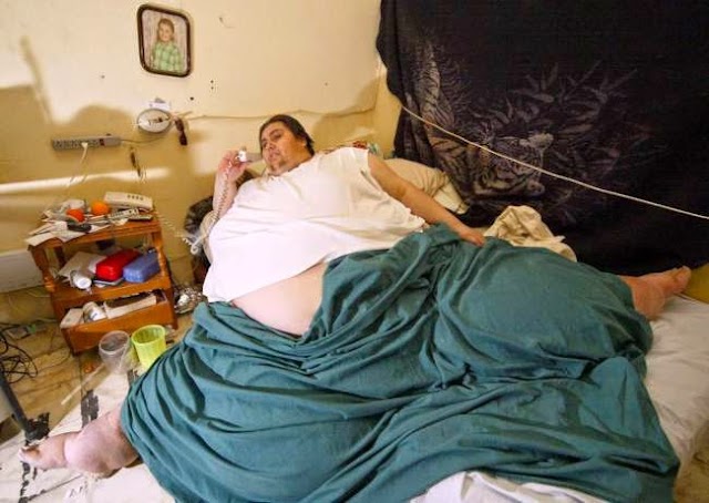 Former World's Fattest Man, Manuel Uribe Dies