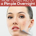 How To Get Rid Of A Pimple Overnight ?