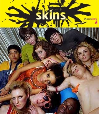 SNEAK PEEK : Toronto Gets Under MTV's Skins