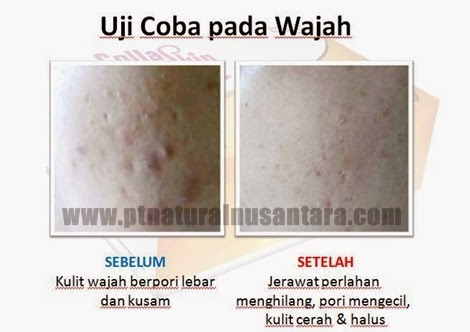 Hasil Uji Coba CollaSkin Nasa Pada Wajah