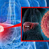 Obat liver tradisional alami thumbnail