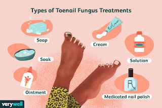 What is the Most Effective Treatment for Toenail Fungus