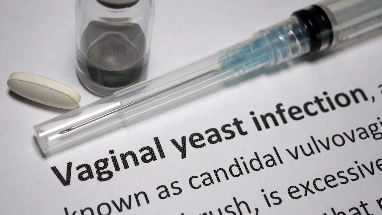 Vaginal yeast infection.